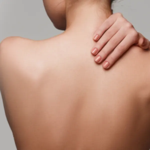 Laser Tattoo Removal