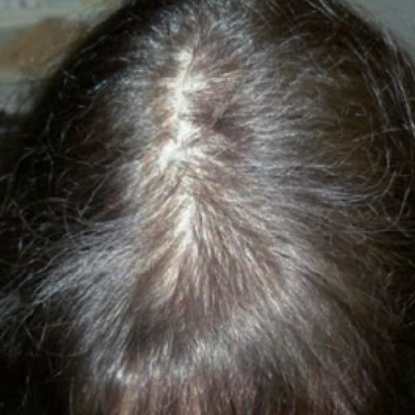 After