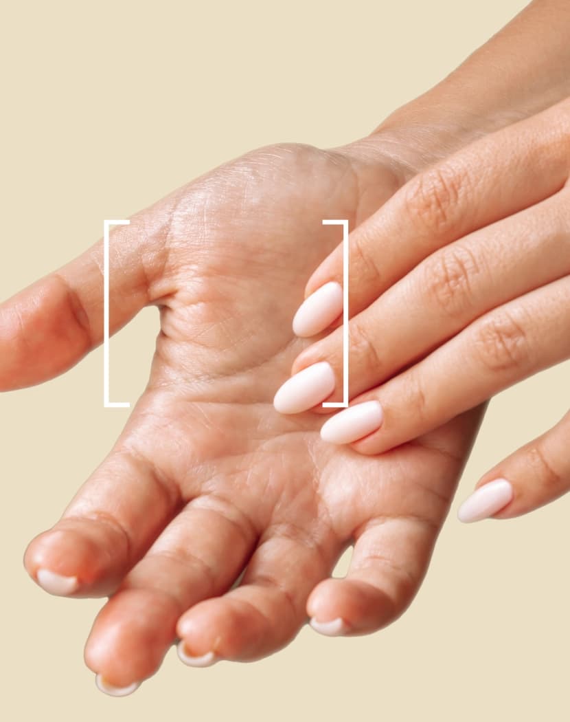 Excessive Sweating Hands