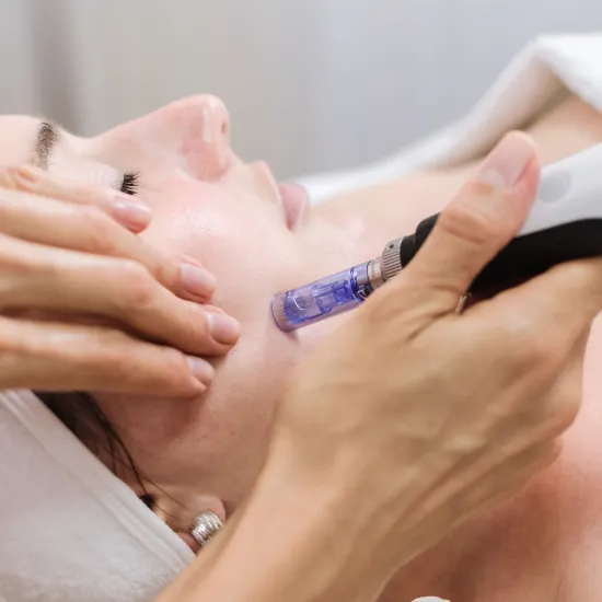 Microneedling Has A Whole Host Of Benefits