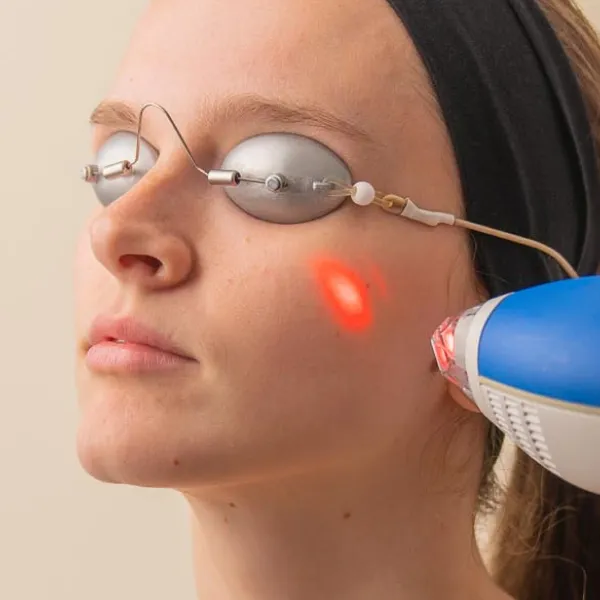 Ultimate Laser Facial 