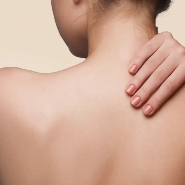 Laser Tattoo Removal