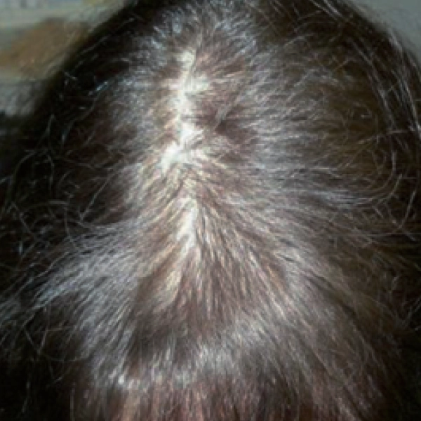 After