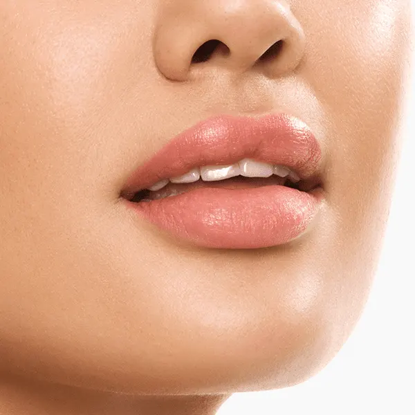 Benefits of Lip Injection Fillers