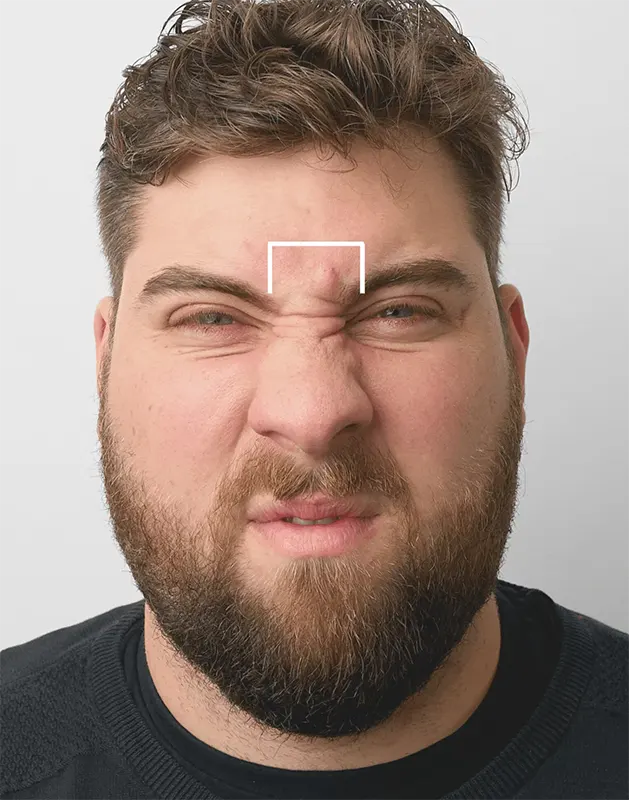 Between the eyebrows