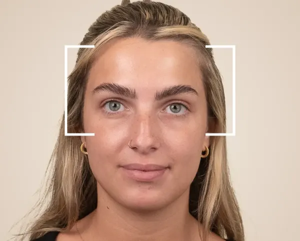 Wrinkle Treatment Wrinkle Treatment