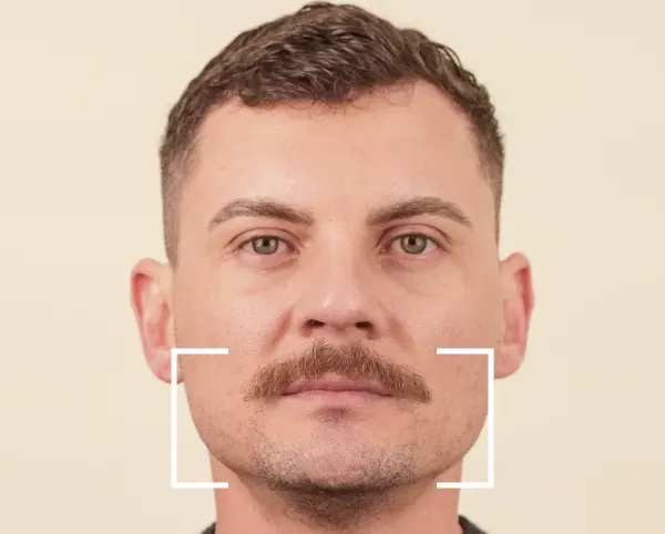 Masseter Masseter