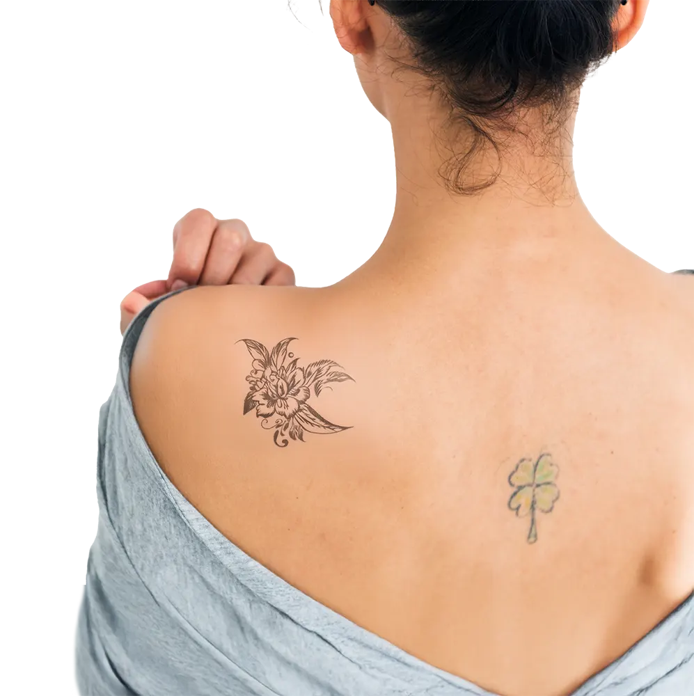 What Are the Benefits of Laser Tattoo Removal? What Are the Benefits of Laser Tattoo Removal?