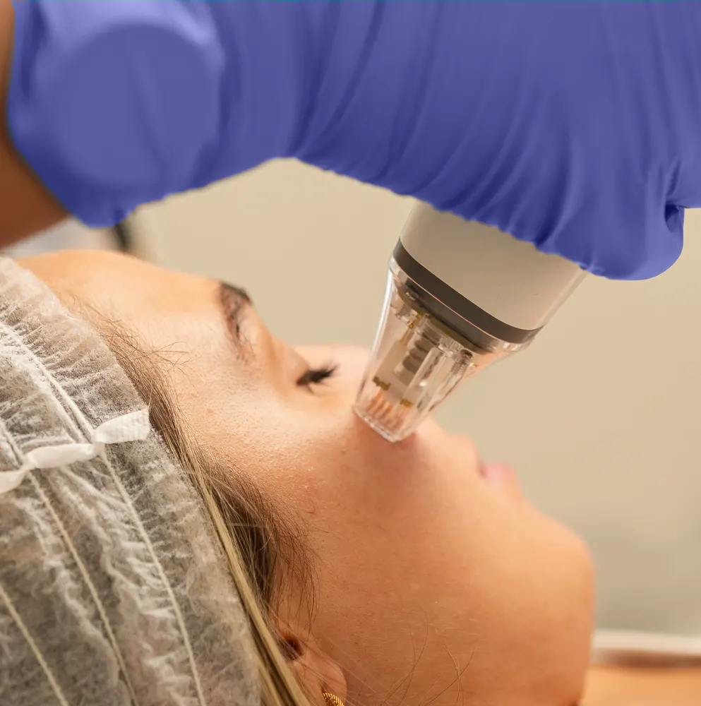 How Many Potenza Treatments Will I Need? How Many Potenza Treatments Will I Need?