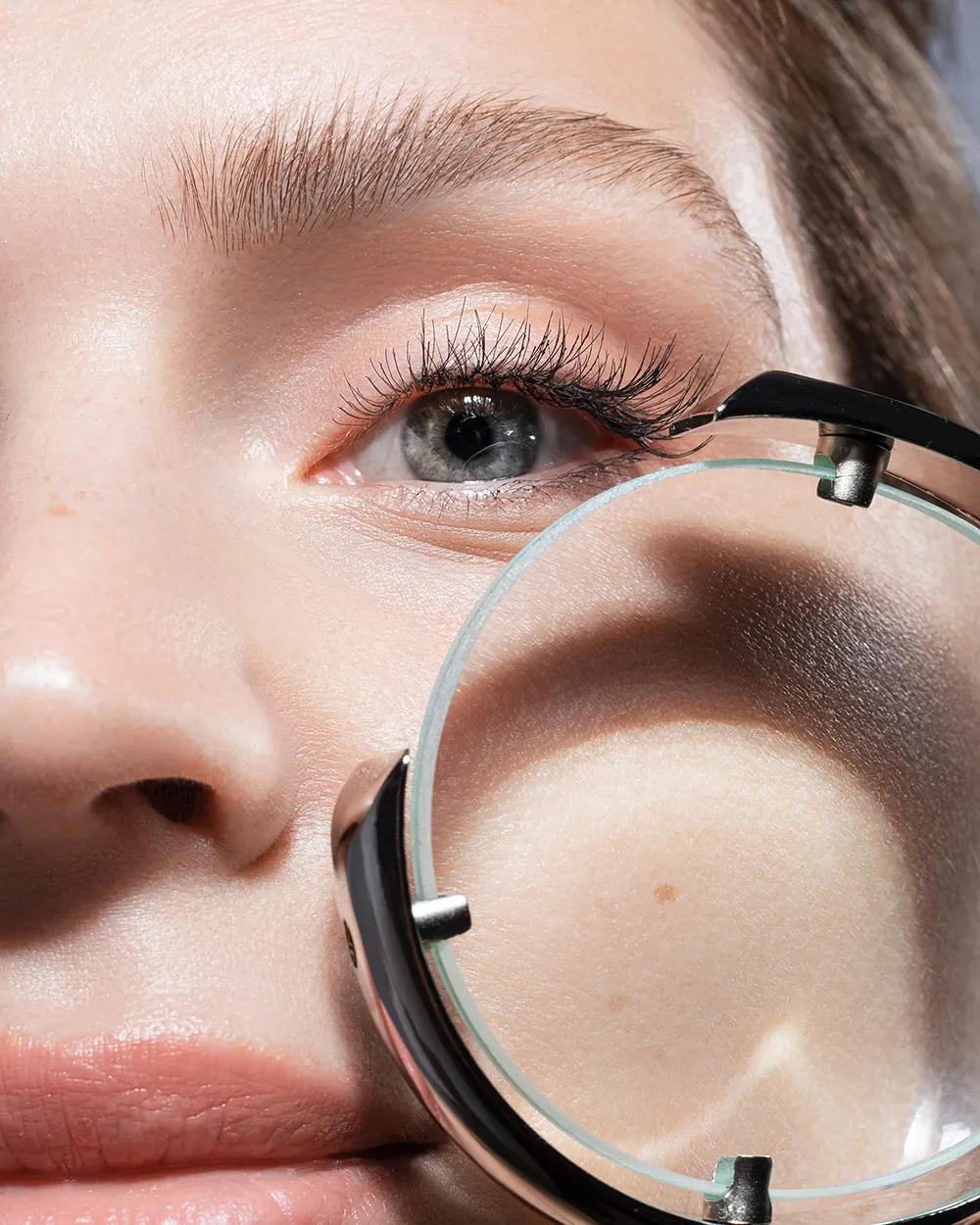 What Areas Can Acne Scar Treatments Target? What Areas Can Acne Scar Treatments Target?