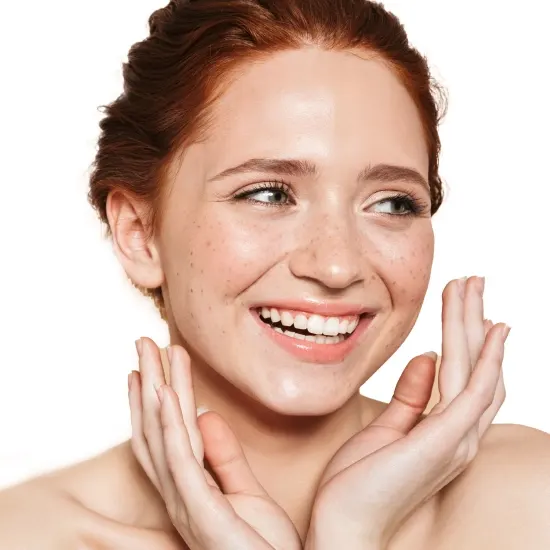 Rosacea Rosacea